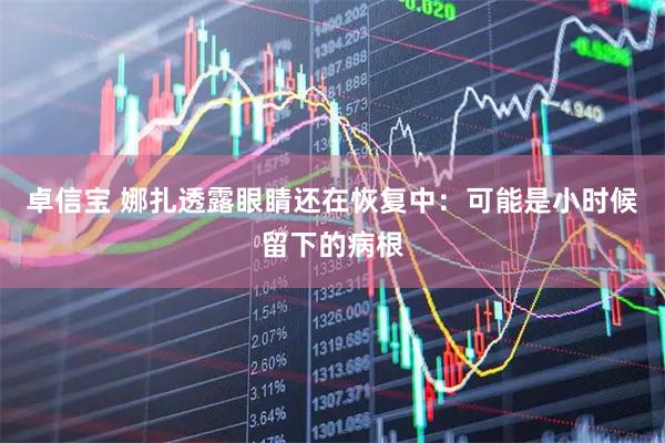 卓信宝 娜扎透露眼睛还在恢复中：可能是小时候留下的病根